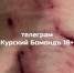 В Курске следователи начали проверку после сообщения о нападении собаки на школьника - KurskTV.Ru